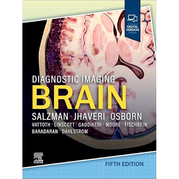Diagnostic Imaging: Brain: 9780443380198: Medicine & Health